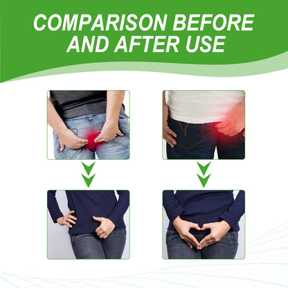 XIMONTH Herbal Hemorrhoid Relief Cream – Fast-Acting Perianal Itch, Pain & Irritation Support