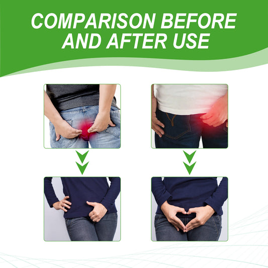 XIMONTH Herbal Hemorrhoid Relief Cream – Fast-Acting Perianal Itch, Pain & Irritation Support