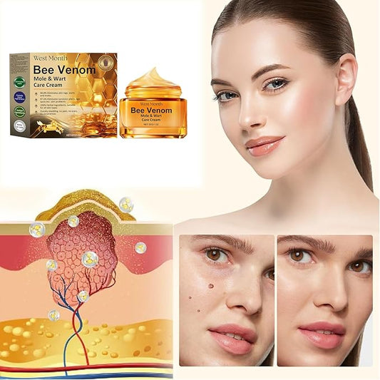 WEST MONTH Wart Removal Cream Professional Herbal Formula No Trace - Get Rid of Warts and Moles Without a Trace with Natural Formula