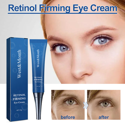 WEST & MONTH Retinol Eye Cream – Anti-Wrinkle, Dark Circle & Firming Moisturizer