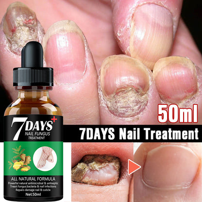 Suero herbal para hongos en las uñas 7DAYS: reparación rápida para uñas descoloridas y quebradizas 