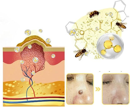WEST MONTH Wart Removal Cream Professional Herbal Formula No Trace - Get Rid of Warts and Moles Without a Trace with Natural Formula