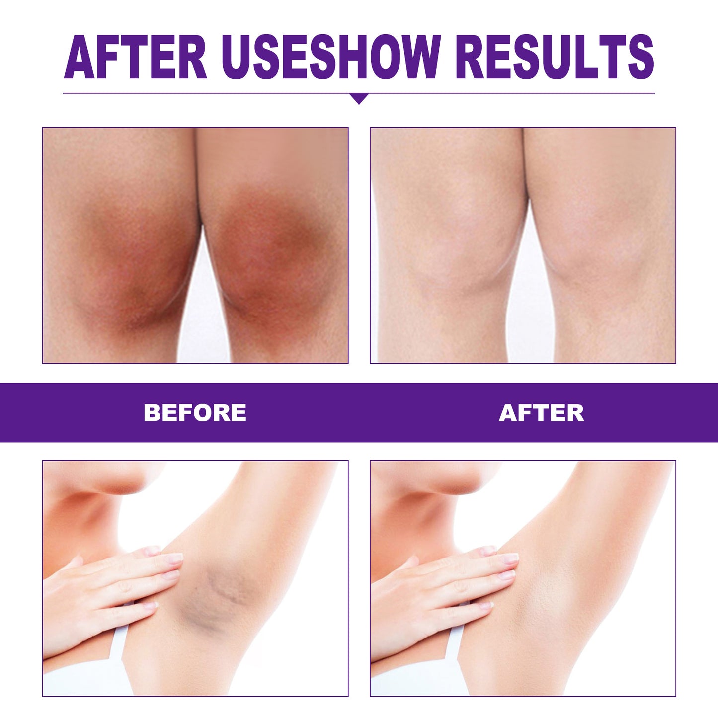 EELHOE Pampering Woman: Indulge Yourself with the Intimate & Vaginal Whitening Cream - Melanin Removal