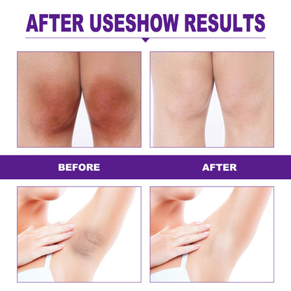 EELHOE Pampering Woman: Indulge Yourself with the Intimate & Vaginal Whitening Cream - Melanin Removal