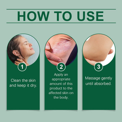Ximonth Plant-Based Support for All Skin Concerns - Psoriasis, Eczema, Skin Allergies, Itching, and Rashes