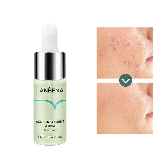 LAMBENA Anti-Acne & Scar Repair Serum – Fast-Acting Skin Corrector