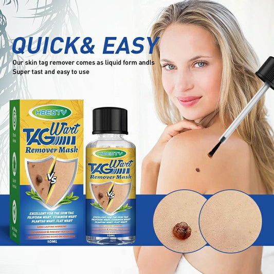 HBESTY Tag Wart Remover - Herbal Facial Mole Removal Solution
