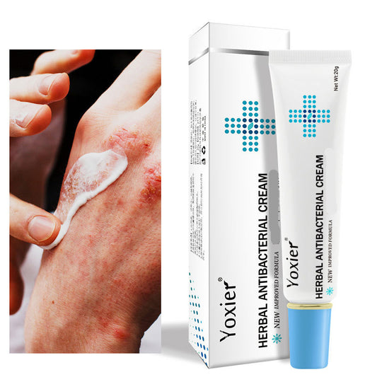 YOXIER Herbal Antibacterial Eczema, Psoriasis & Dermatitis Cream – Fast-Acting Itch, Redness & Peeling Relief (20G)