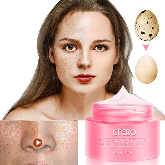 EFERO Freckle & Blemish Cream 30ml – Dark Spot Corrector, Pore Minimizer & Anti-Aging
