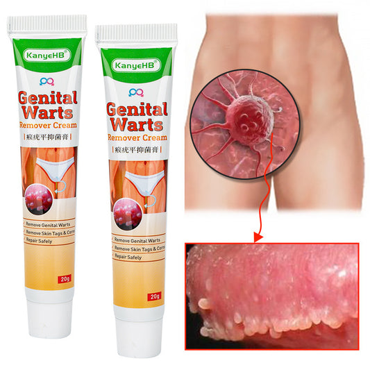 KanyeHB Bee Venom Wart & Skin Tag Removal Cream – Genital & Body Warts Treatment