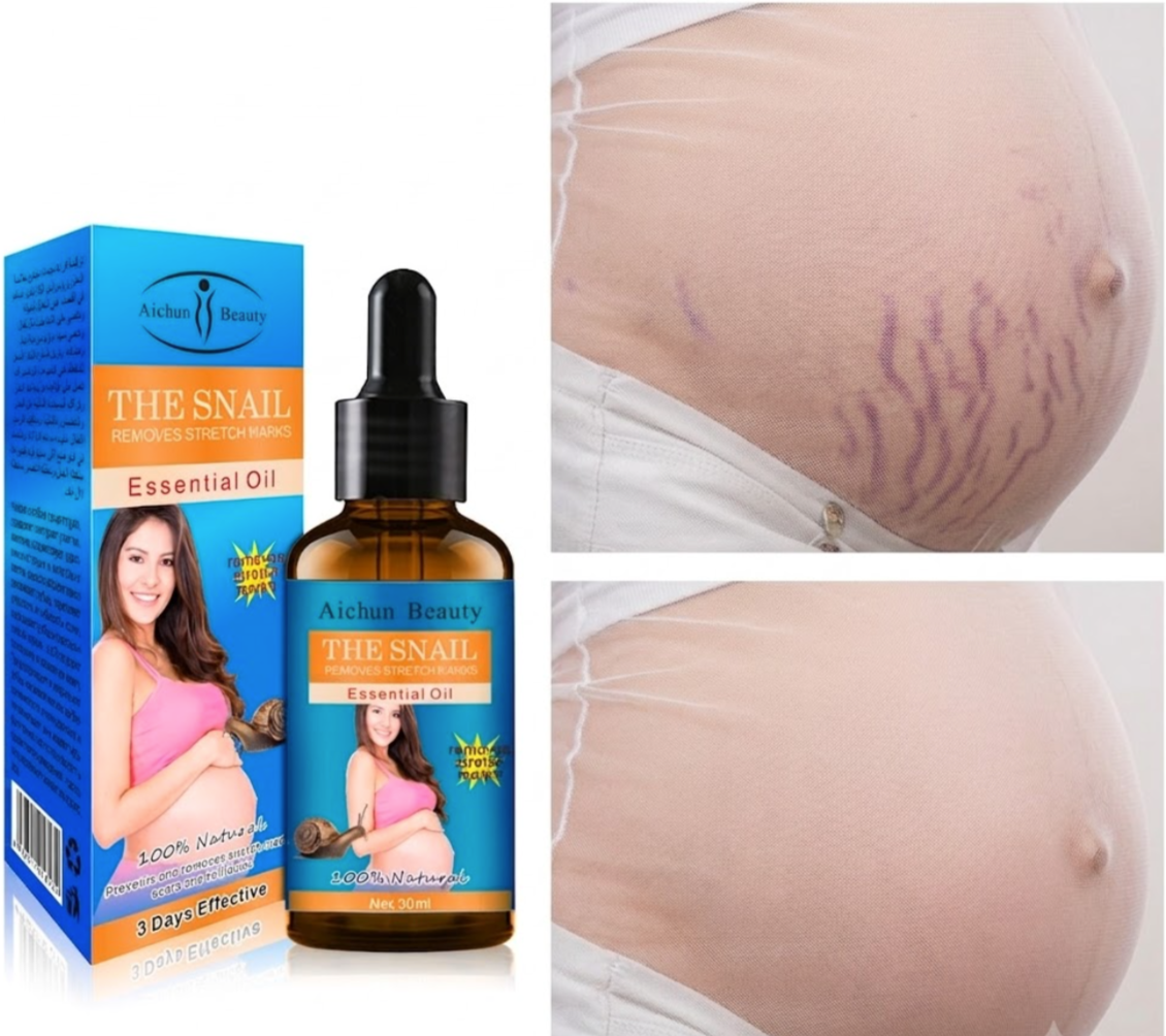 AICHUN BEAUTY Snail Postpartum Belly Massage Oil - Natural Stretch Mark Repair, Abdominal Skin Toning & Elasticity Recovery Treatment (30ml)