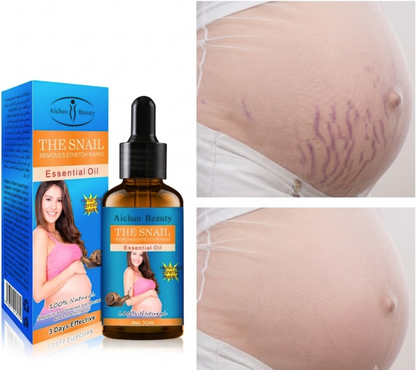 AICHUN BEAUTY Snail Postpartum Belly Massage Oil - Natural Stretch Mark Repair, Abdominal Skin Toning & Elasticity Recovery Treatment (30ml)