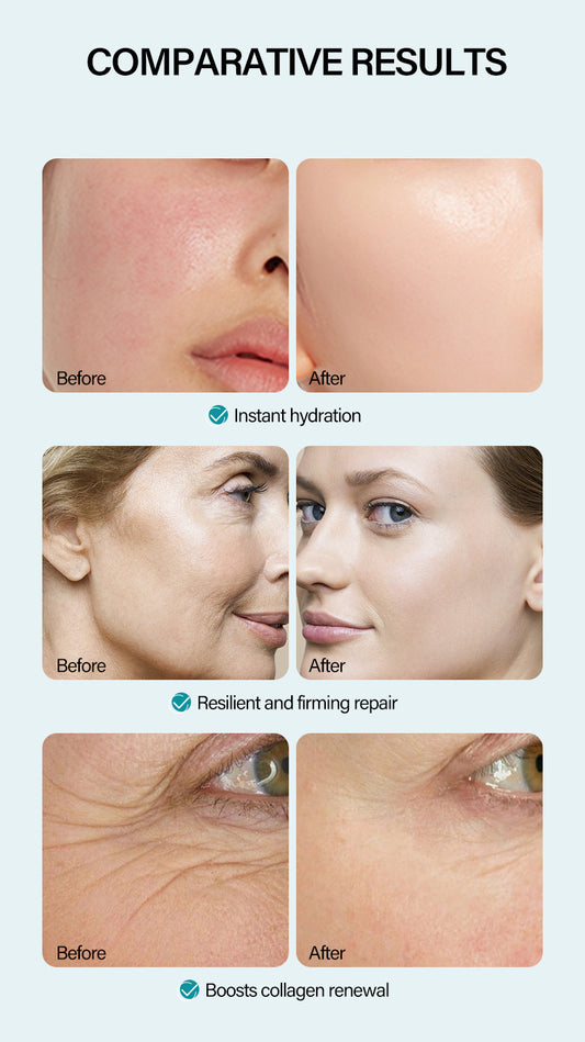 MOOYAM Hyaluronic Acid Collagen Anti-Wrinkle High Moisturizing Revitalizing Face Cream 50ml