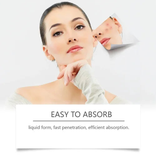 Googeer Eczema & Psoriasis Herbal Drops – Natural Skin Soothing & Hydration