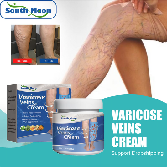 SOUTH MOON Varicose Vein and Leg Pain Relief Ointment, Phlebitis Soothing, Effective Support for Vasculitis, Worm and Spider Vein Appearance