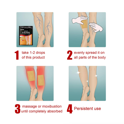 SOUTH MOON Varicose Vein Patch – Relief for Vasculitis, Phlebitis, and Spider Veins, Anti-Swelling, Leg Pain Reliever