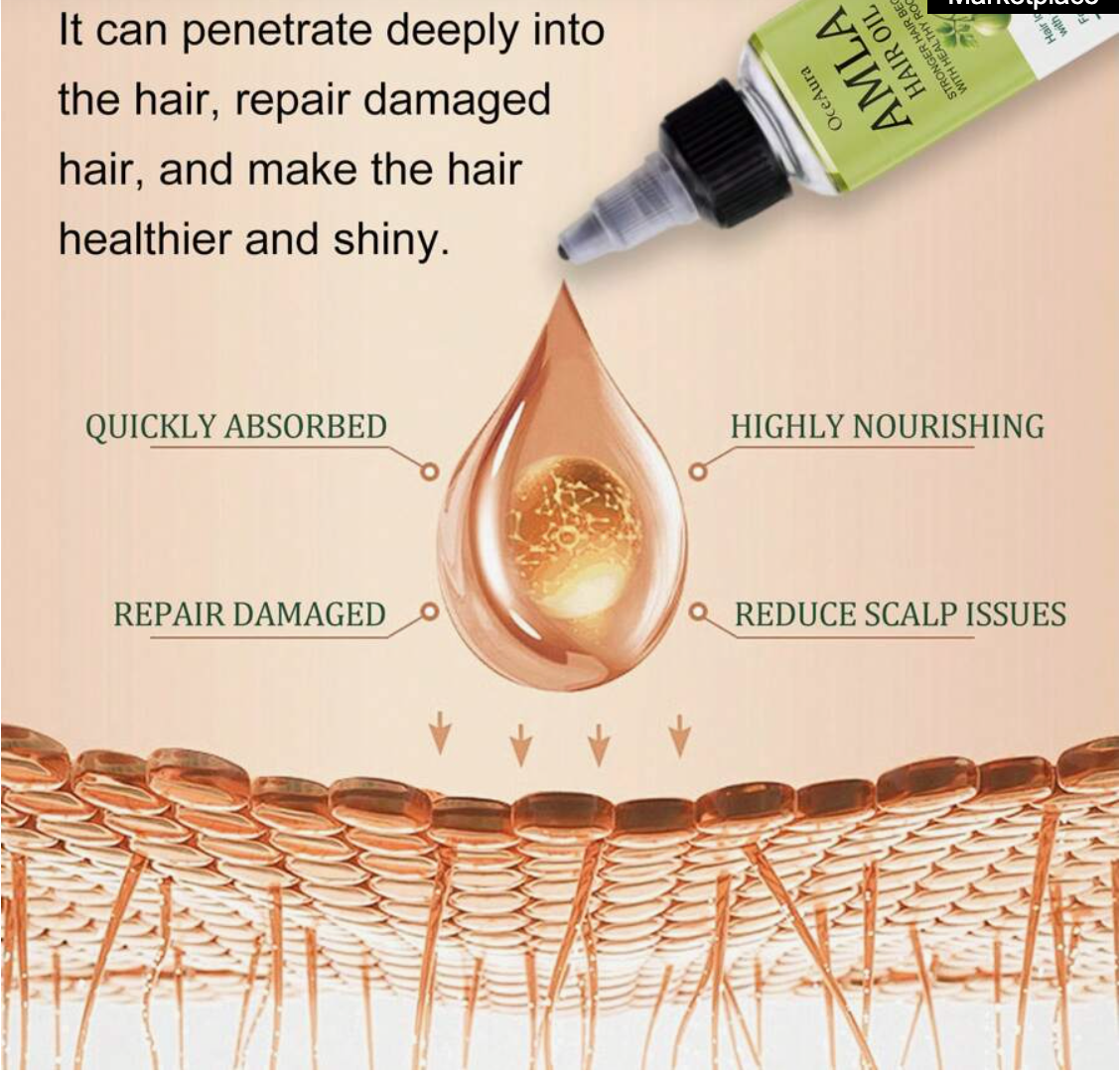 OCE AURA Hair Loss Prevention Essential Oil & Anti-Hair Loss Herbal Support