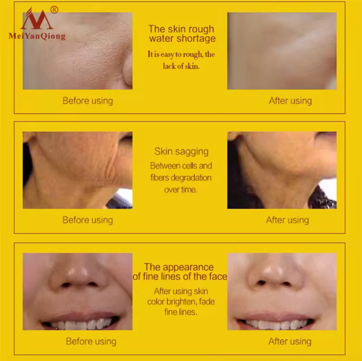 MEI YAN QIONG Pure 24K Gold Anti-Aging, Anti-Wrinkle, Collagen Whitening, Moisturizing Hyaluronic Acid Day Cream - Buy 3 Pay For 2