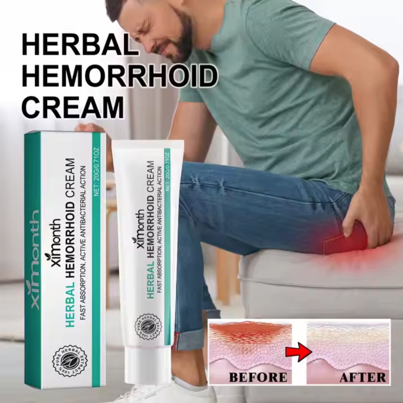 XiMONTH Herbal Hemorrhoid Cream – Fast & Natural Relief!
