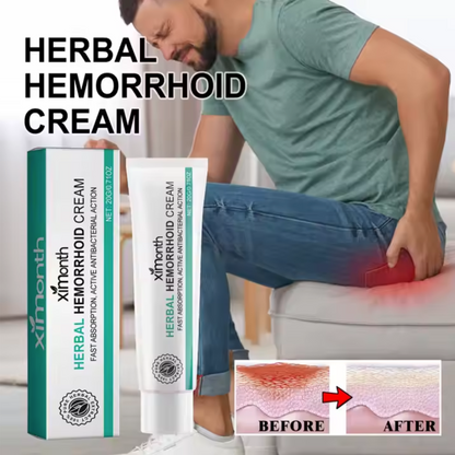 XiMONTH Herbal Hemorrhoid Cream – Fast & Natural Relief!