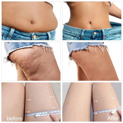 SODSNIE Fat Burning & Firming Cream  – Cellulite Reduction & Body Shaping with Niacinamide