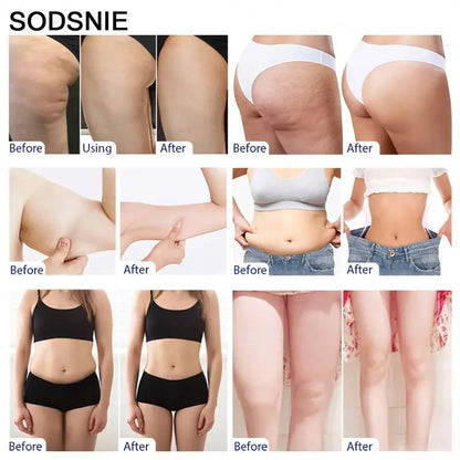 SODSNIE Fat Burning & Firming Cream  – Cellulite Reduction & Body Shaping with Niacinamide