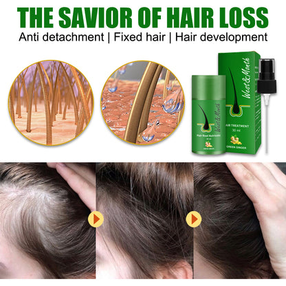 Suero para el crecimiento del cabello a base de hierbas con extracto de jengibre de WEST &amp; MONTH: fórmula anticaída del cabello: compre 3 y pague 2