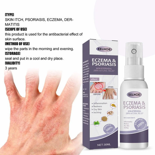 EELHOE Natural Eczema & Psoriasis Relief Spray – Fast-Acting Itch, Redness & Dryness Solution (50ml)