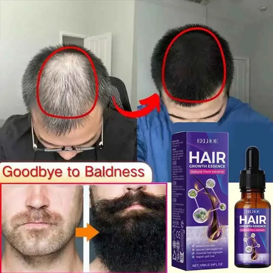 Hair Growth Essential Loss Regrowth Support Strengthens Hair Nourishes Scalp Light Weight Non Greasy Improve Scalp Circulation