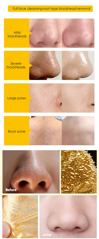 YOXIER Collagen 24K Gold Facial Mask Moisturizing, Blackhead and Acne Remover, Anti-Oxidation, Anti-Aging Skin Care Mask