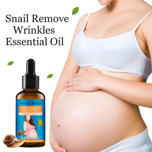 AICHUN BEAUTY Snail Belly Massage Oil (30ml) – Postpartum Skin Toning & Stretch Mark Appearance