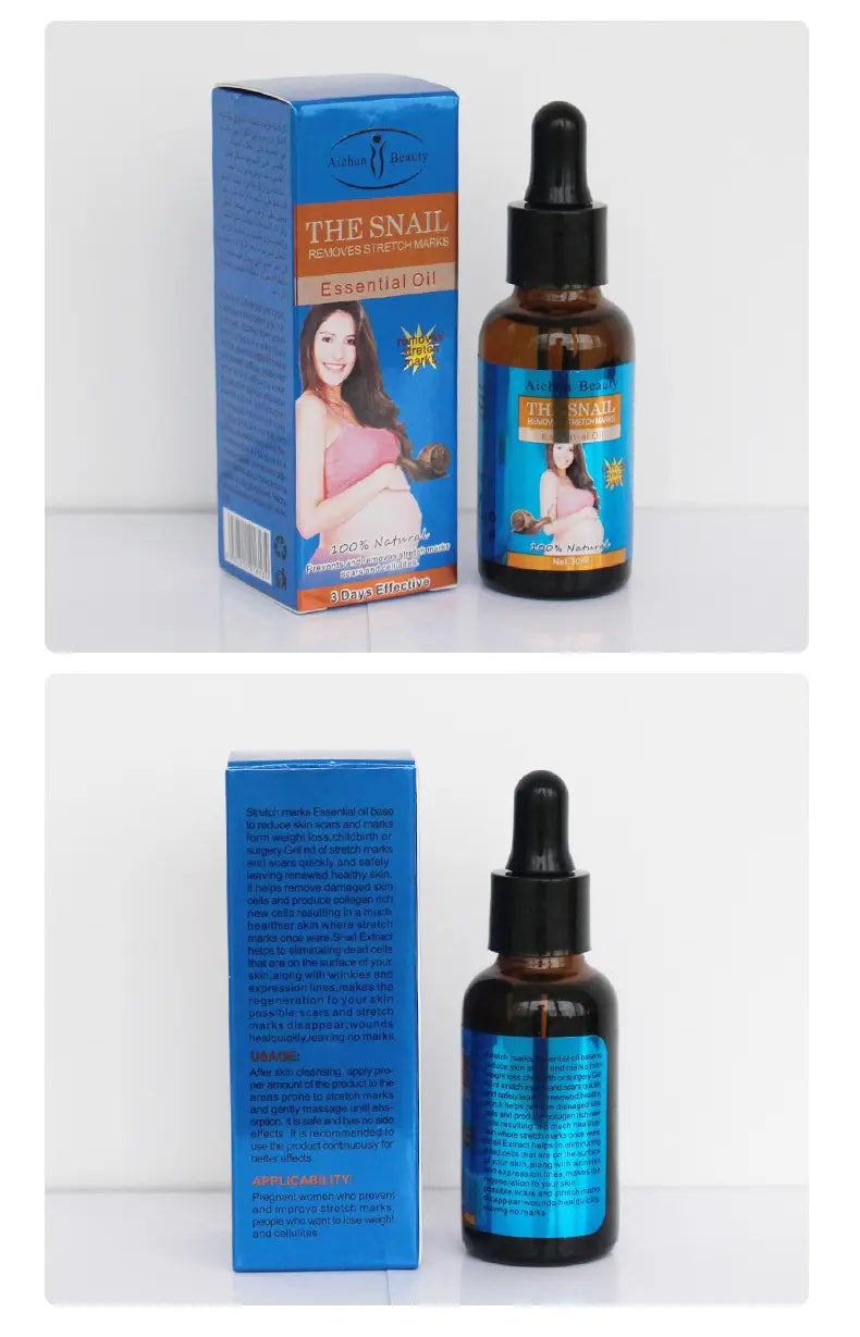 AICHUN BEAUTY Snail Belly Massage Oil (30ml) – Postpartum Skin Toning & Stretch Mark Appearance
