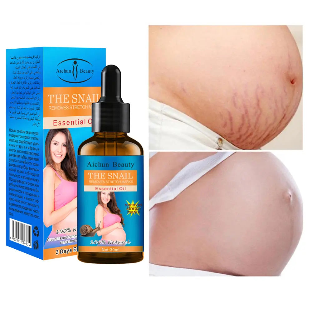 AICHUN BEAUTY Snail Belly Massage Oil (30ml) – Postpartum Skin Toning & Stretch Mark Appearance