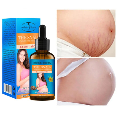 AICHUN BEAUTY Snail Belly Massage Oil (30ml) – Postpartum Skin Toning & Stretch Mark Appearance
