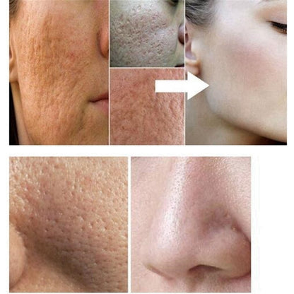 CZLMI Pore Refining Serum – Multi-Active Hydrating & Anti-Aging Face Serum (10ml)