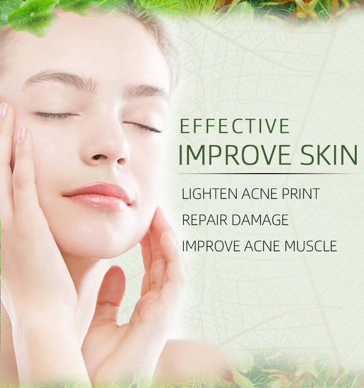JoyPretty Herbal Acne Cream For Reducing Acne Marks