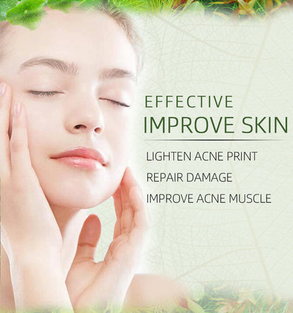 JoyPretty Herbal Acne Cream For Reducing Acne Marks