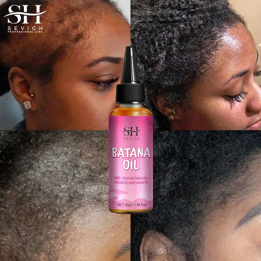 Anti-hair Loss Essential Oil Solid Butter - Batana oil, Batana Shampoo, Batana Sprey, Batana Hair Mask