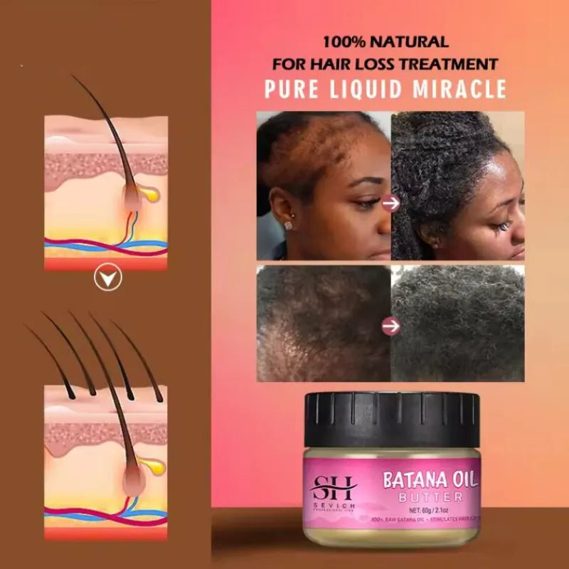 Anti-hair Loss Essential Oil Solid Butter - Batana oil, Batana Shampoo, Batana Sprey, Batana Hair Mask
