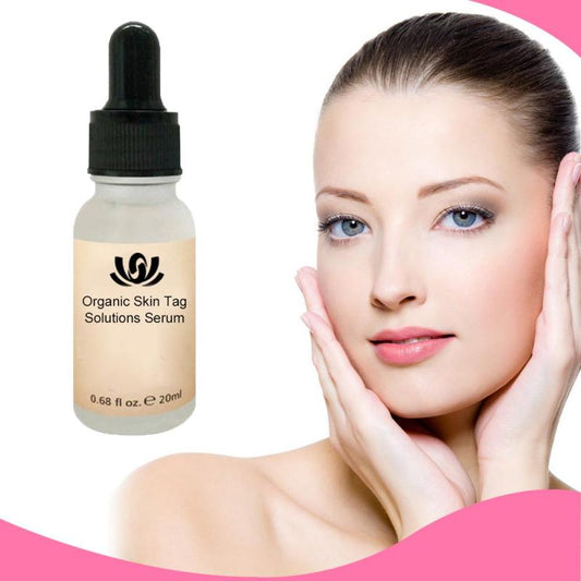Blemish & Wart & Acne Removal Serum (Organic)
