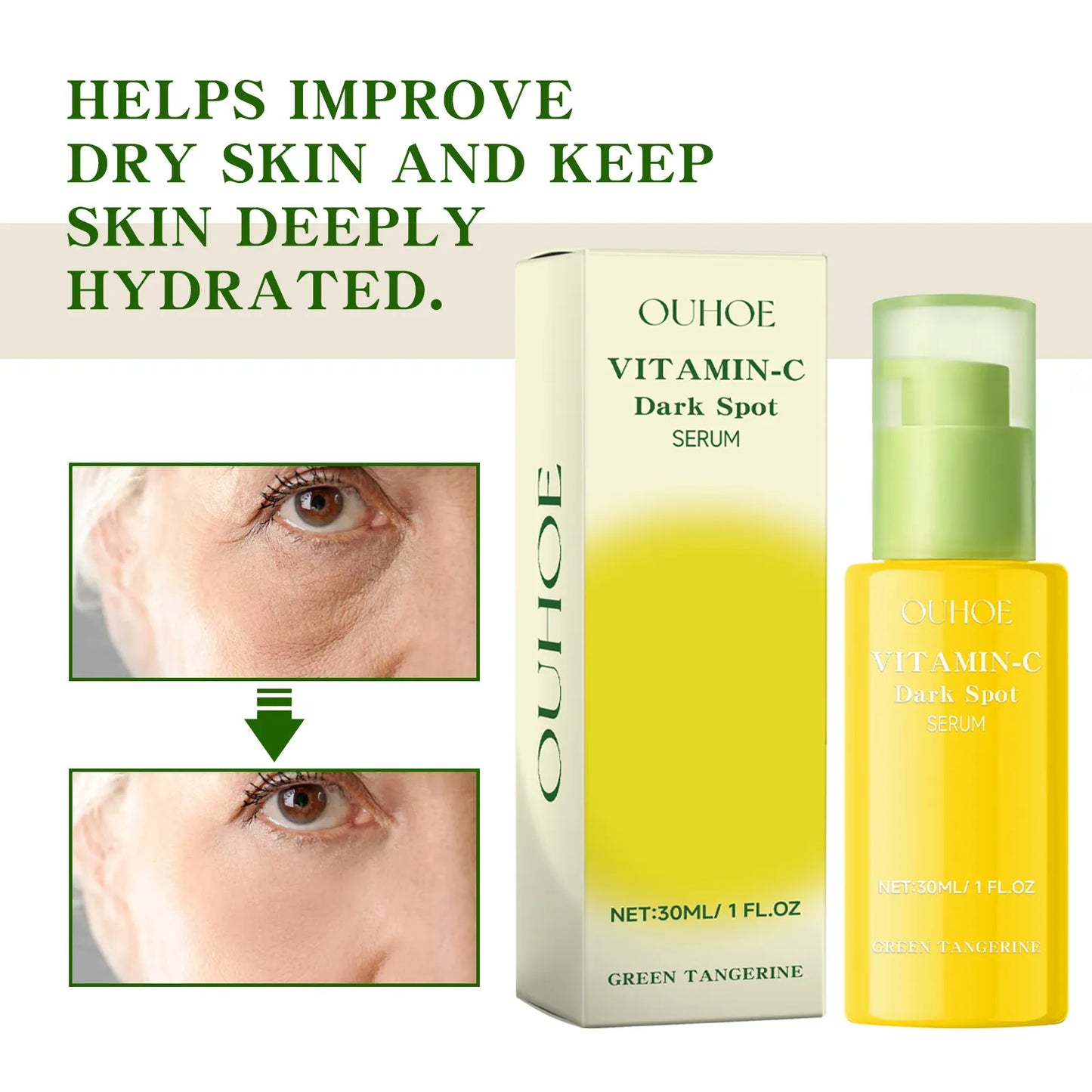 Ouhoe Vitamin C Dark Spot Serum – Niacinamide, Hyaluronic Acid for Brightening, Anti-Aging & Pore Minimizing (30ml)