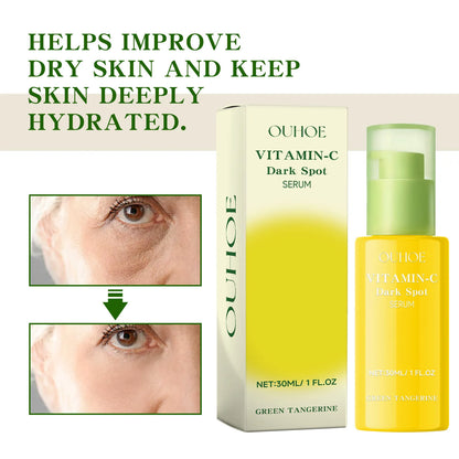 Ouhoe Vitamin C Dark Spot Serum – Niacinamide, Hyaluronic Acid for Brightening, Anti-Aging & Pore Minimizing (30ml)