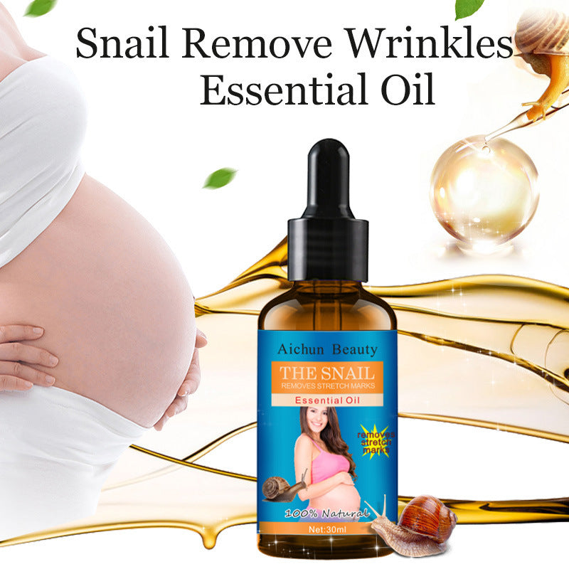 AICHUN BEAUTY Snail Belly Massage Oil (30ml) – Postpartum Skin Toning & Stretch Mark Appearance