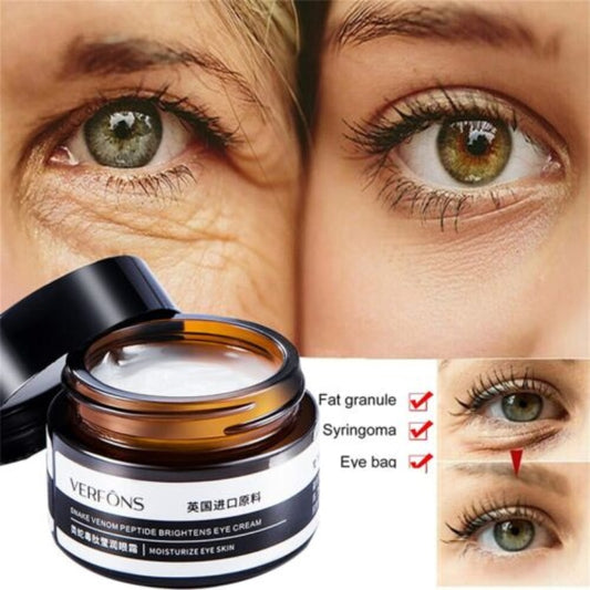 VERFONS Anti-Aging Eye Cream: Firming, Hydrating & Dark Circle Reducer for Fine Lines & Elasticity (30g)