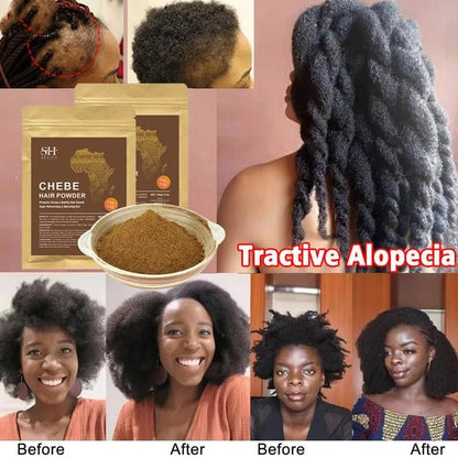 SEVICH Chebe Powder - African Hair Growth, Strengthening, and Anti-Hair Loss Herbal Support