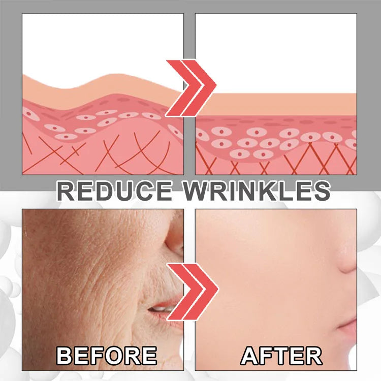 EELHOE Intensive Collagen Wrinkle Remover and Skin Plumping Cream