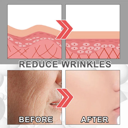 EELHOE Intensive Collagen Wrinkle Remover and Skin Plumping Cream