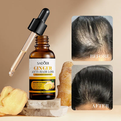 SADOER Ginger Hair Loss Herbal Support Oil - Anti-Hair Loss Formula