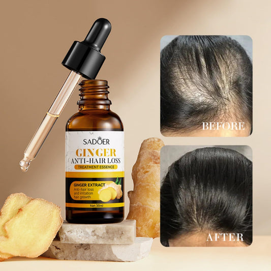 SADOER Ginger Hair Loss Herbal Support Oil - Anti-Hair Loss Formula