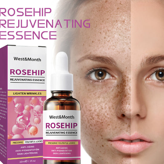 Rose Fruit Skin Rejuvenation Toner – Hydrating, Freckle & Dark Spot Remover